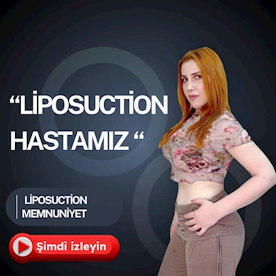 Liposuction Hastamız